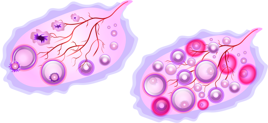 Ovulation in women's ovary 